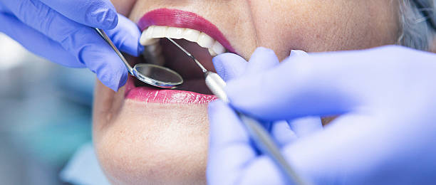 Best Emergency Dental Care for Sports Injuries in Port Aransas, TX